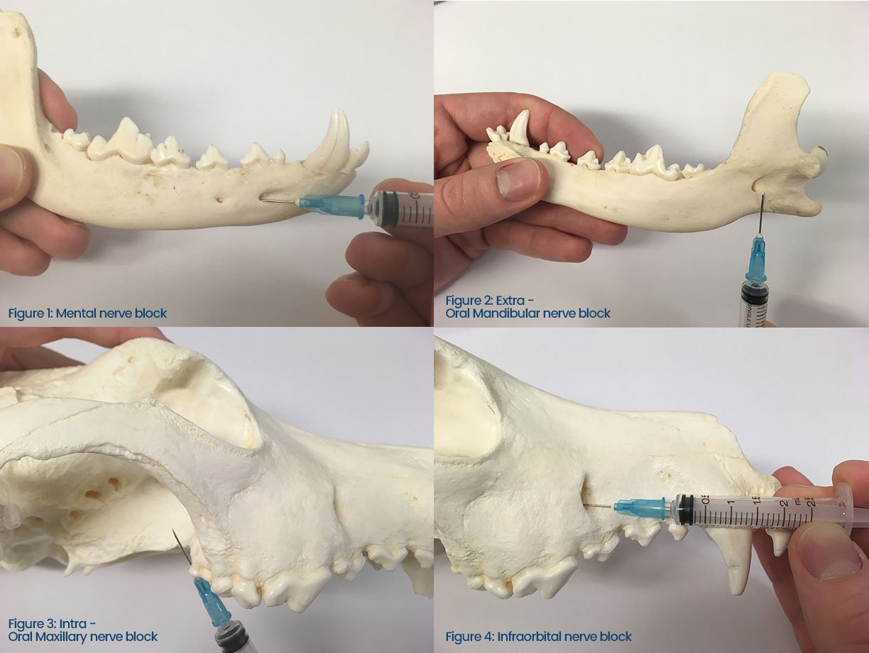 Anaesthesia For The Dental Patient